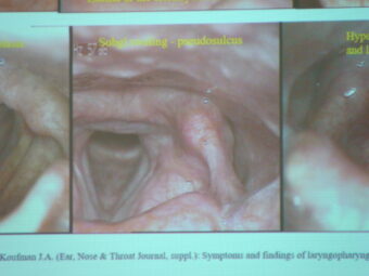 45. sjezd SAOF – FOTO 063