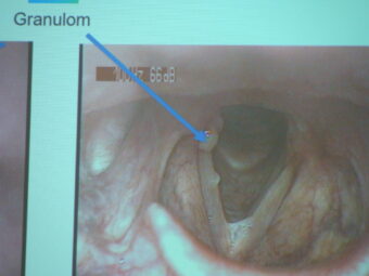 45. sjezd SAOF – FOTO 066